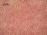 5 – Cellule corticali in visione superficiale